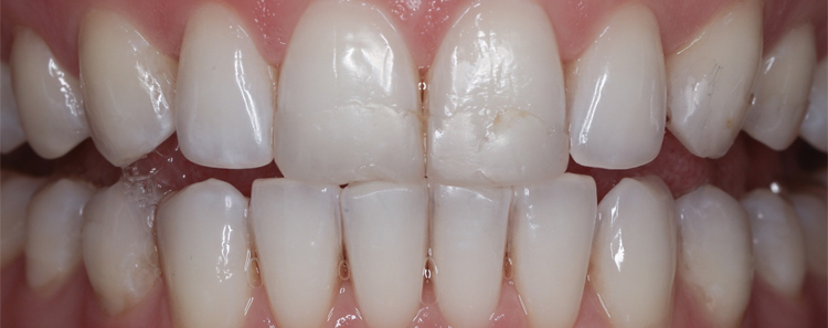  Before & After Photo