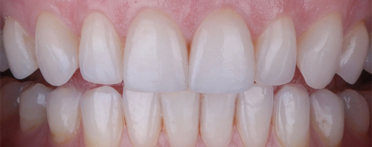  Before & After Photo