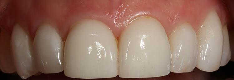 Before & After Photo