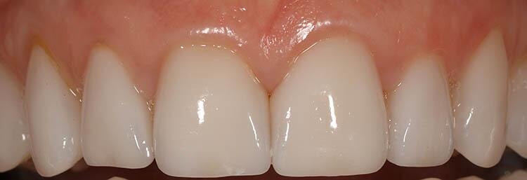 Before & After Photo