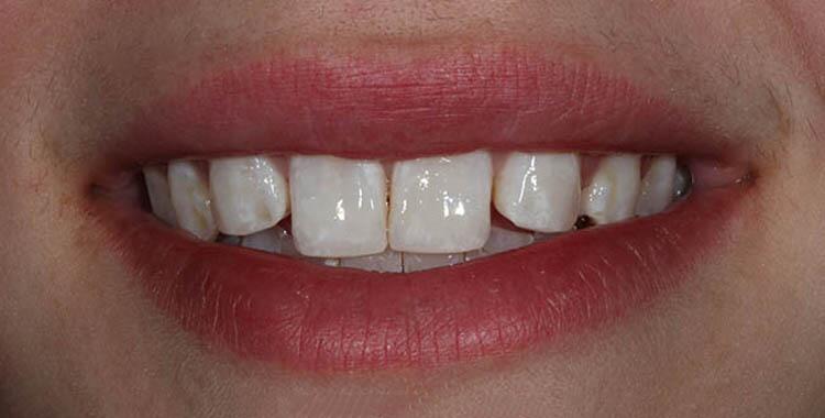 Before & After Photo