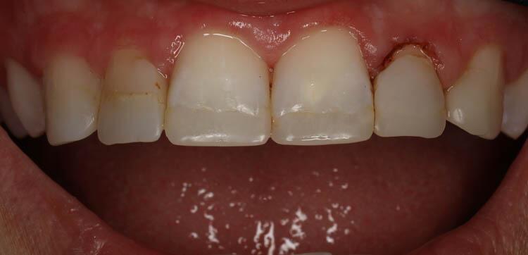Before & After Photo