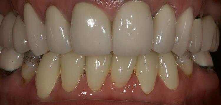 Before & After Photo