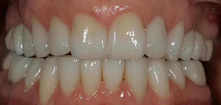 Before & After Photo