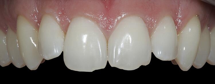 Before & After Photo