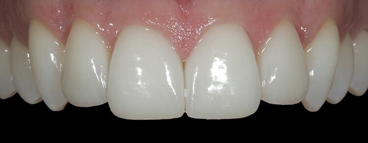 Before & After Photo