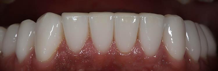 Before & After Photo