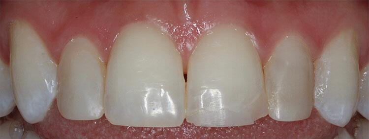 Before & After Photo